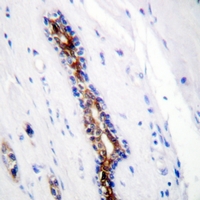 19 - Anti-IRAK1 Antibody AP61292