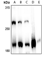 1 - Anti-MLL1 Antibody AP61295