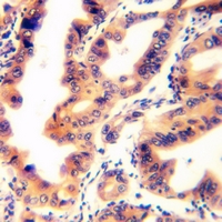 19 - Anti-TPD52L2 Antibody AP61297