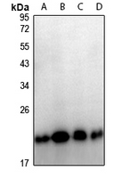 1 - Anti-TPD52L2 Antibody AP61297