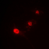 3 - Anti-ST18 Antibody AP61298