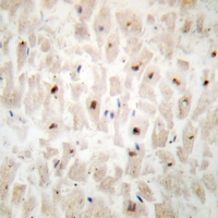 19 - Anti-ST18 Antibody AP61298
