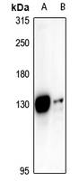 1 - Anti-ST18 Antibody AP61298