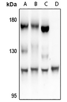 1 - Anti-FARP2 Antibody AP61299