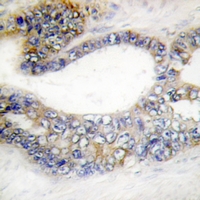 19 - Anti-DCR3 Antibody AP61300