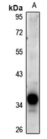 1 - Anti-DCR3 Antibody AP61300