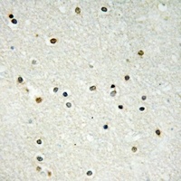 19 - Anti-CBX6 Antibody AP61301