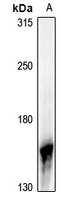 1 - Anti-NGK Antibody AP61302