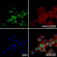 3 - Anti-ZNF18 Antibody AP61303