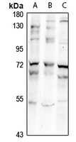 1 - Anti-ZNF18 Antibody AP61303
