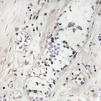 19 - Anti-ZNF23 Antibody AP61304