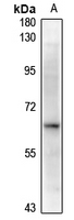 1 - Anti-Alpha-2B Adrenergic Receptor Antibody AP61305