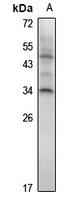 1 - Anti-HOXA7 Antibody AP61306