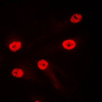 3 - Anti-LMO4 Antibody AP61307