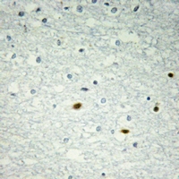19 - Anti-LMO4 Antibody AP61307