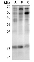 1 - Anti-LMO4 Antibody AP61307