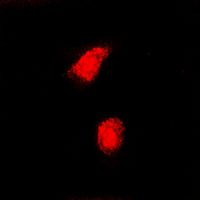 3 - Anti-CAF-I p60 Antibody AP61309