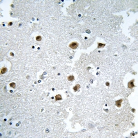 19 - Anti-CAF-I p60 Antibody AP61309
