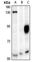 1 - Anti-CAF-I p60 Antibody AP61309