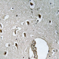 19 - Anti-HLX Antibody AP61310
