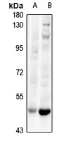 1 - Anti-HLX Antibody AP61310
