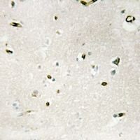 19 - Anti-WTAP Antibody AP61311