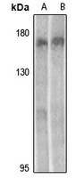 1 - Anti-MEKK15 Antibody AP61312