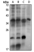 1 - Anti-DLX4 Antibody AP61315