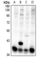 1 - Anti-BWR1A Antibody AP61316