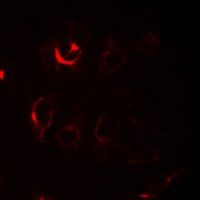 3 - Anti-ILKAP Antibody AP61317