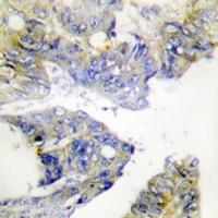 19 - Anti-ILKAP Antibody AP61317