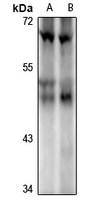 1 - Anti-ILKAP Antibody AP61317