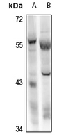 1 - Anti-RBPJL Antibody AP61318