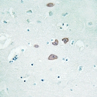 19 - Anti-STON1 Antibody AP61319