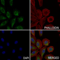 3 - Anti-CDK5RAP1 Antibody AP61320