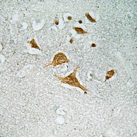 19 - Anti-CDK5RAP1 Antibody AP61320