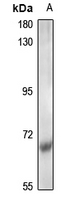 1 - Anti-CDK5RAP1 Antibody AP61320