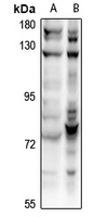 1 - Anti-CDC16 Antibody AP61321
