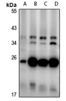 1 - Anti-CD160 Antibody AP61322