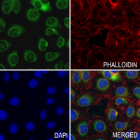 3 - Anti-Aquaporin 5 Antibody AP61326