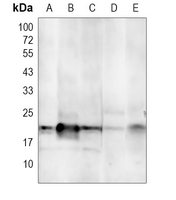 1 - Anti-Aquaporin 5 Antibody AP61326