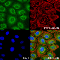 3 - Anti-Carboxypeptidase M Antibody AP61327