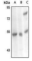 1 - Anti-Carboxypeptidase M Antibody AP61327