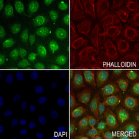 3 - Anti-CHSY3 Antibody AP61329