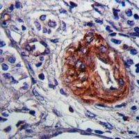 19 - Anti-CHSY3 Antibody AP61329