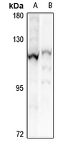 1 - Anti-CHSY3 Antibody AP61329