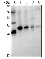 1 - Anti-GSTT1 Antibody AP61332