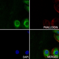 3 - Anti-GNA14 Antibody AP61334