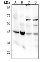 1 - Anti-GNA14 Antibody AP61334