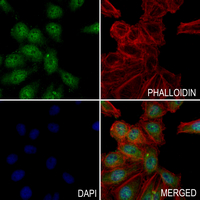 3 - Anti-SIX5 Antibody AP61335